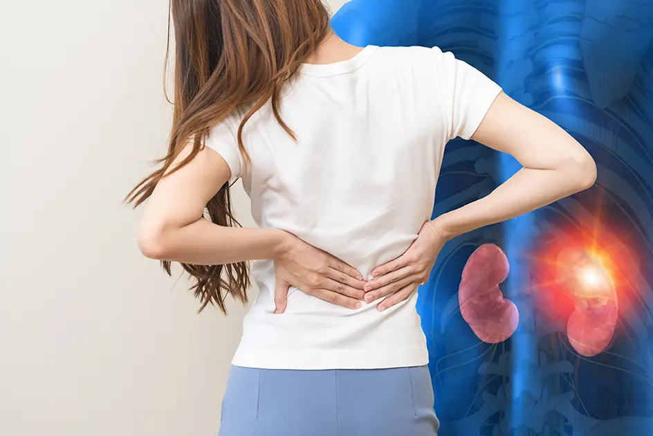 A woman holding holding her back in pain with an x-ray illustration of kidneys.